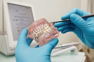 Orthodontic-Treatment-scaled-1-1024x683